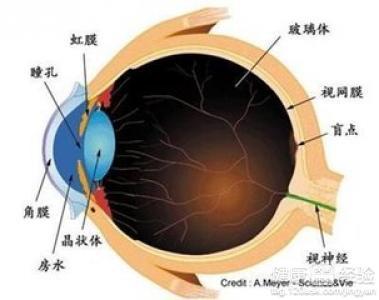 玻璃体混浊治疗新突破，特效药物与创新策略引领治疗新方向